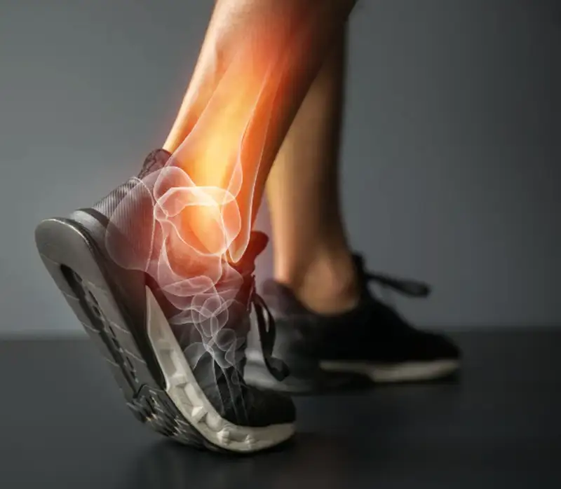 Runner with an illustrated ankle x-ray overlay